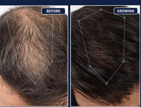 Imported FEG Plus Hair Strong Growth Spray