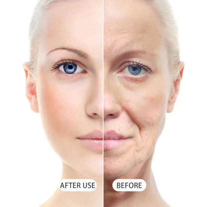 Botox Bee Venom Wrinkle Removal Cream