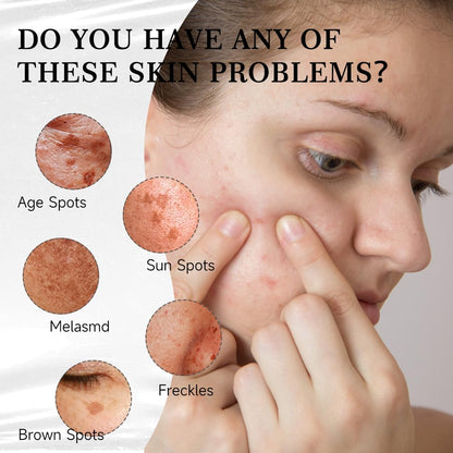 Aobenz Dark Spot Remover