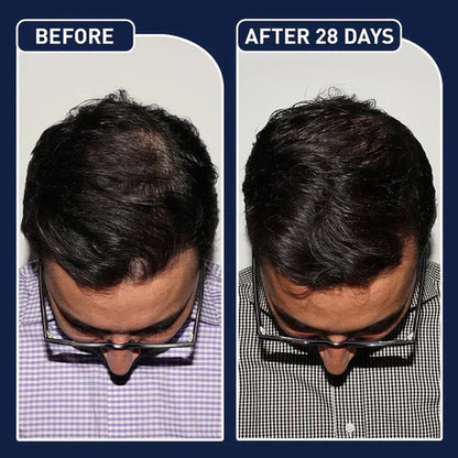 Imported FEG Plus Hair Strong Growth Spray