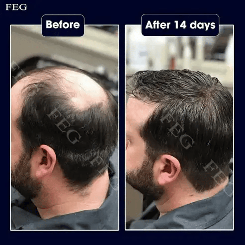 Imported FEG Plus Hair Strong Growth Spray