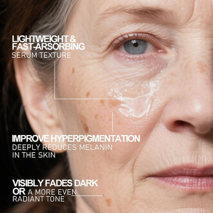 Aobenz Dark Spot Remover