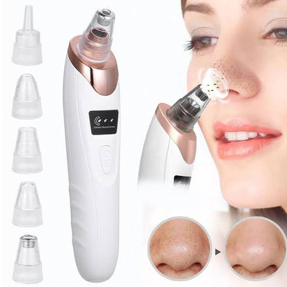 Imported Blackhead Remover
