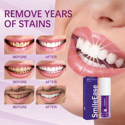 HiSmile V34™ – No More Yellow Stains, Just Bright Smiles