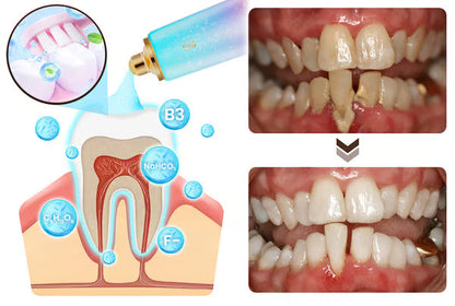 Imported  Niacinamide Whitening Toothpaste