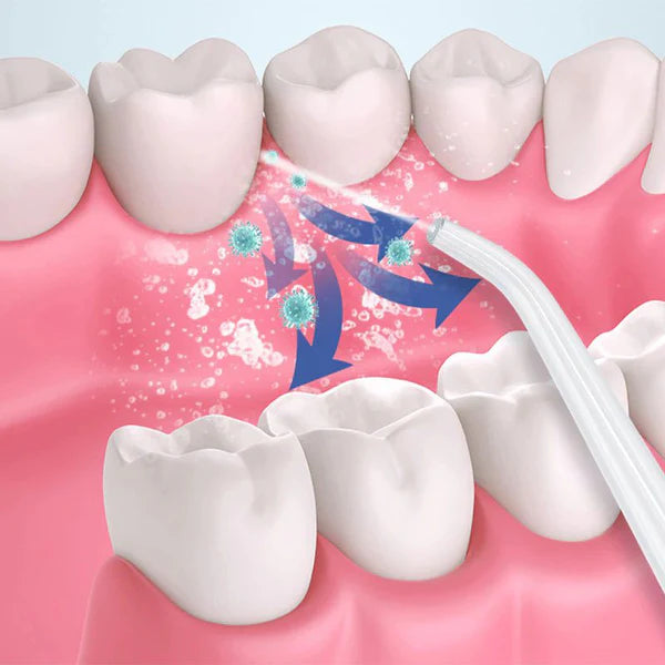 Water Flosser The luxury of cleaning with water